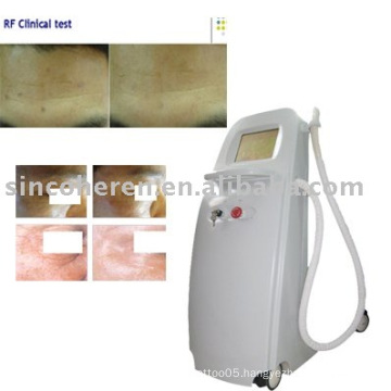 RF-100 Face Lift Beauty Equipment Sincoheren